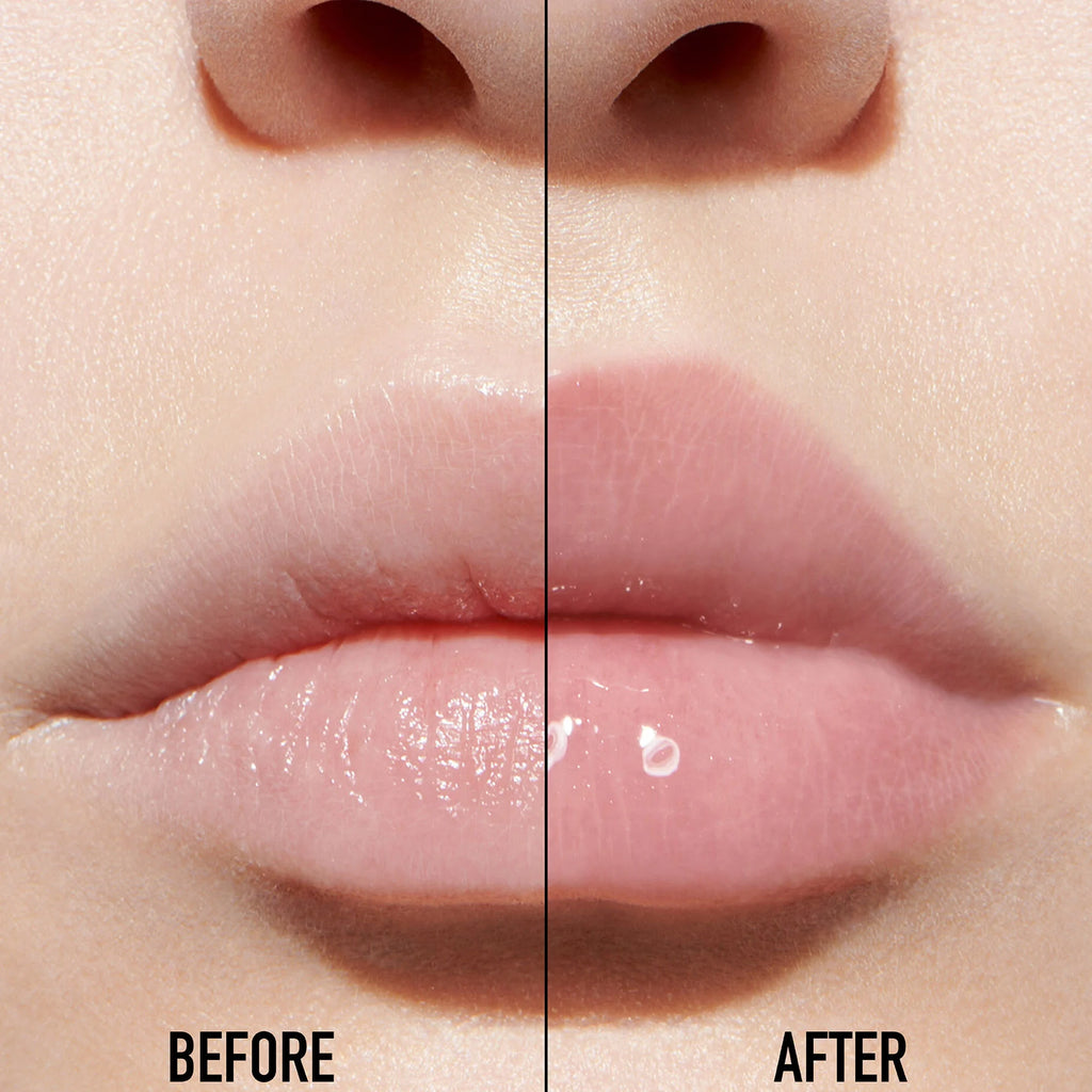 Lip Maximazer Atenea