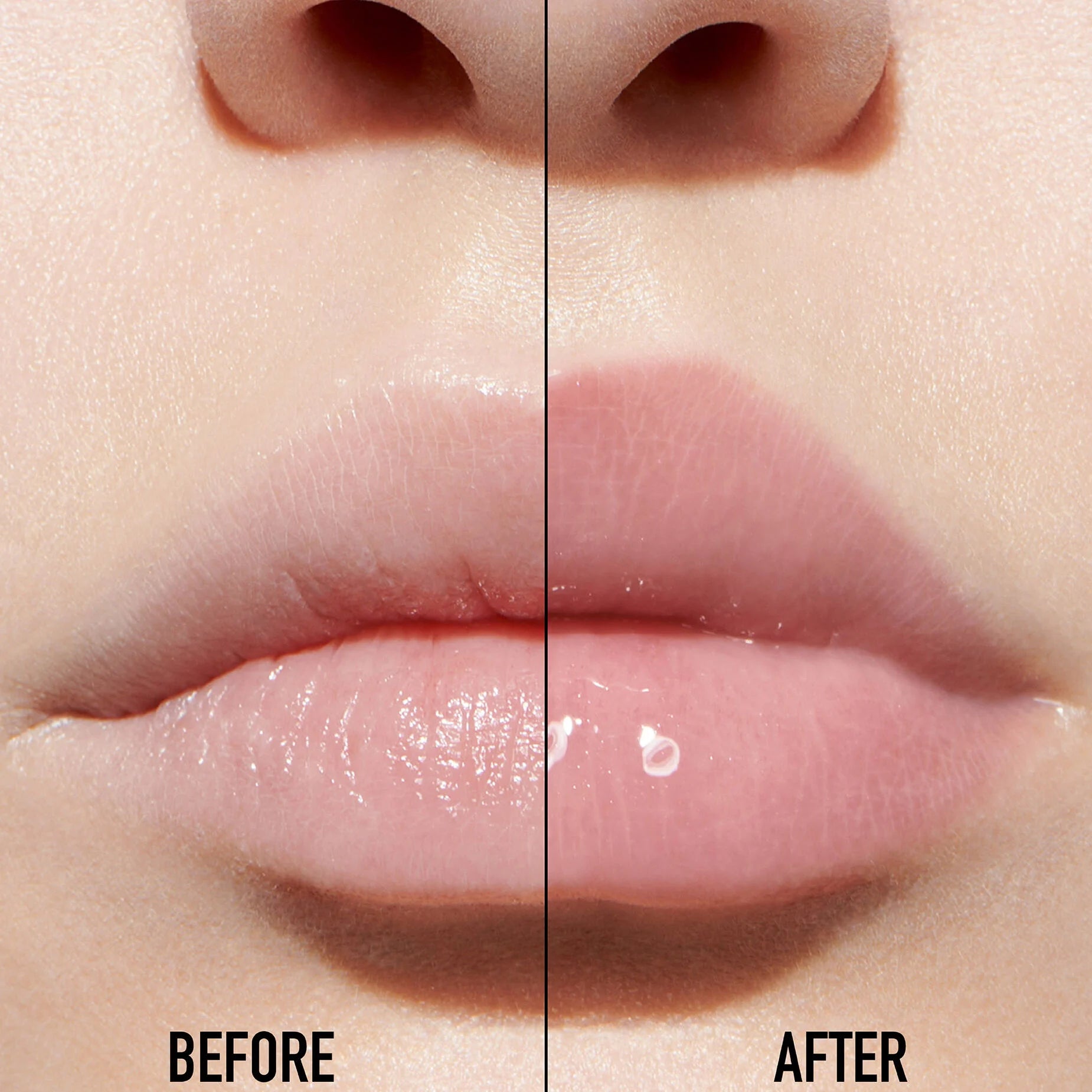 Lip Maximazer Atenea